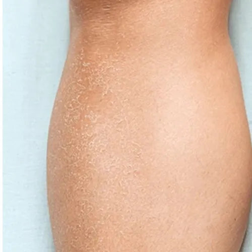 Body_Wash_Before