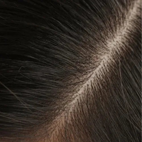 Hair_Dandruf_after