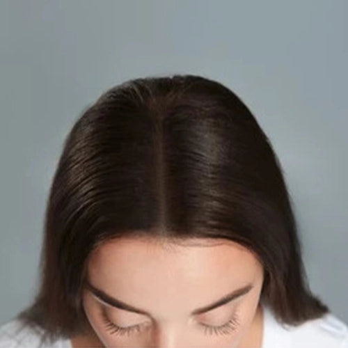 Hair_Fall_After