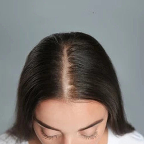 Hair_Fall_Before